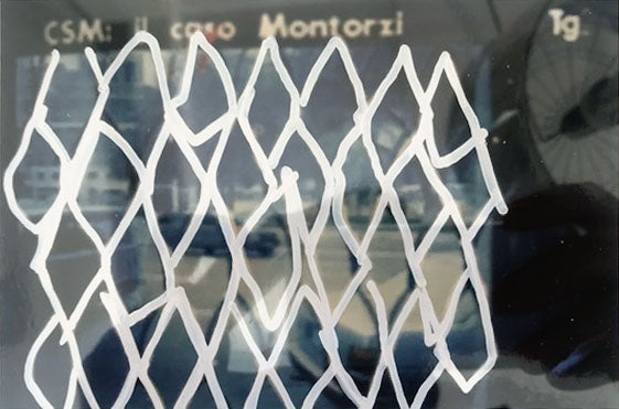 Mario Schifano - CSM, el caso Mantozzi